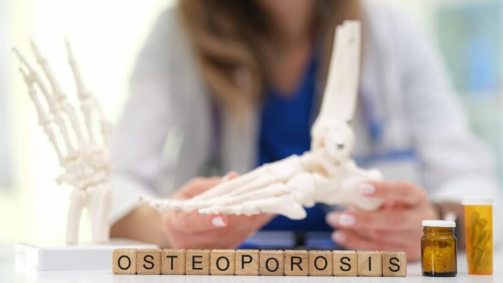 Early Warning Signs of Osteoporosis: Understanding Osteoporosis: A Brief Overview