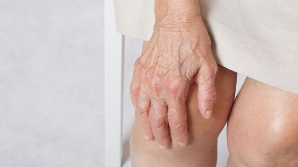 Steps to Prevent Osteoporosis in Younger Adults